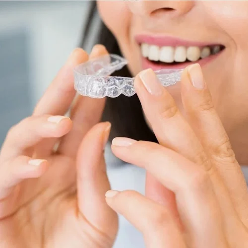 l'ortodonzia dal dott.Brognoli permette di indossare apparecchi fissi, mobili e/o mascherine Invisalign che rendono i tuoi denti dritti in poco tempo.